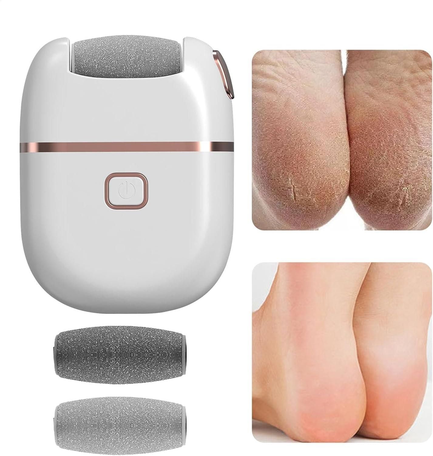 Electronic Pedicure Tool – Smooth, Soft Feet in Minutes!