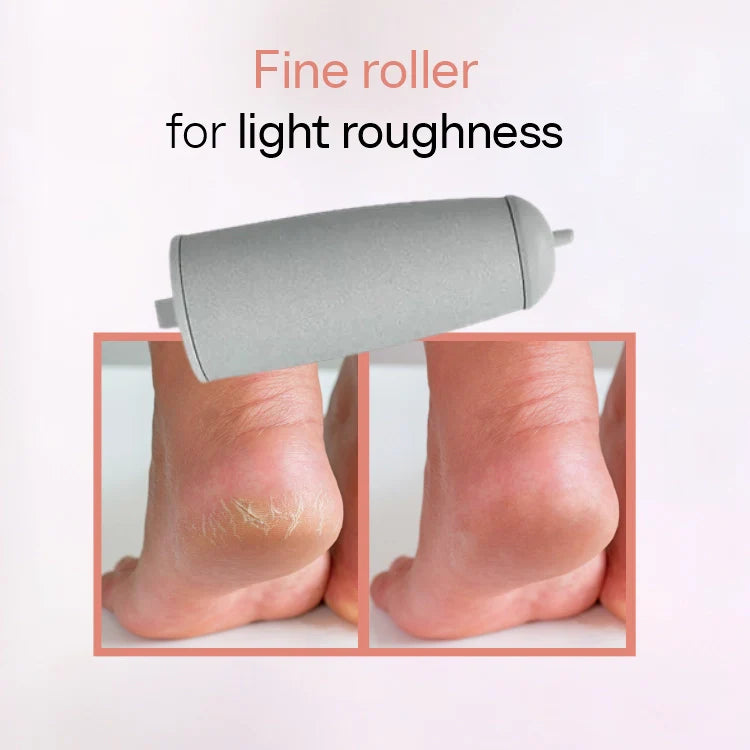 SilkStep™ - Rechargeable Electric Foot Callus Remover