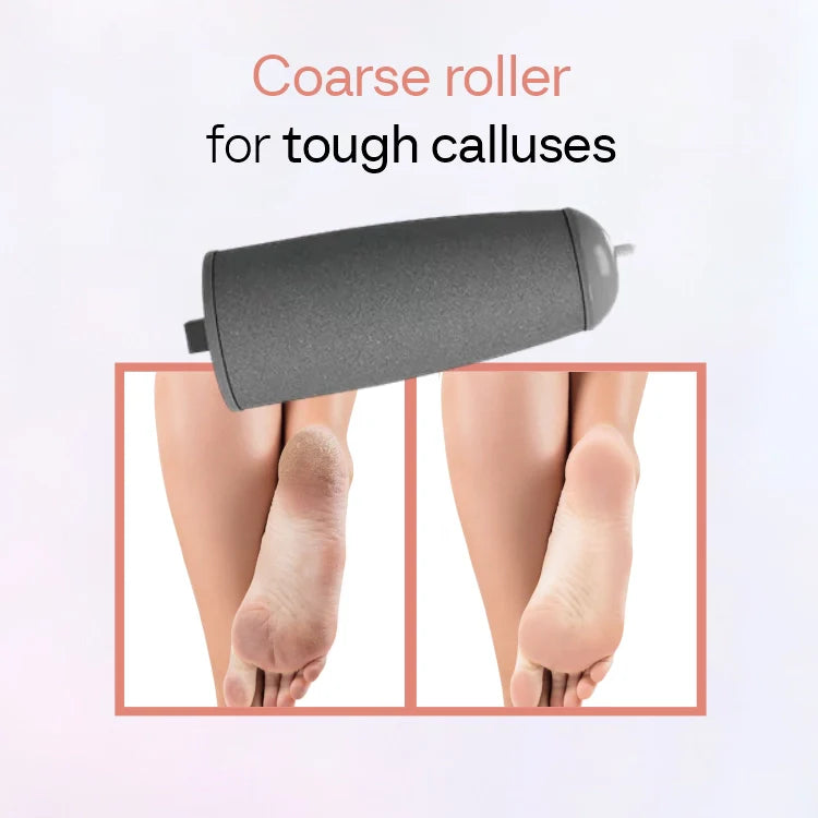 SilkStep™ - Rechargeable Electric Foot Callus Remover