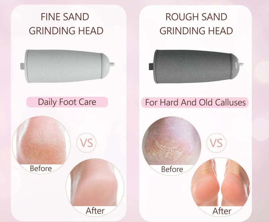 SilkStep™ - Rechargeable Electric Foot Callus Remover